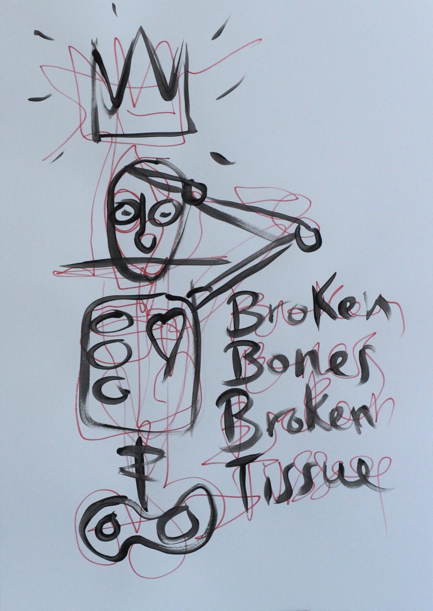 Broken Bones, Broken Tissue by Mark Barrable