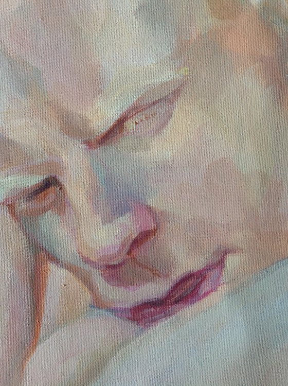 Albino youth