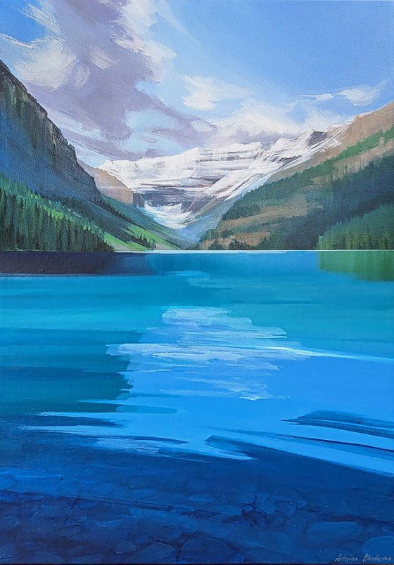 Lake Louise #1