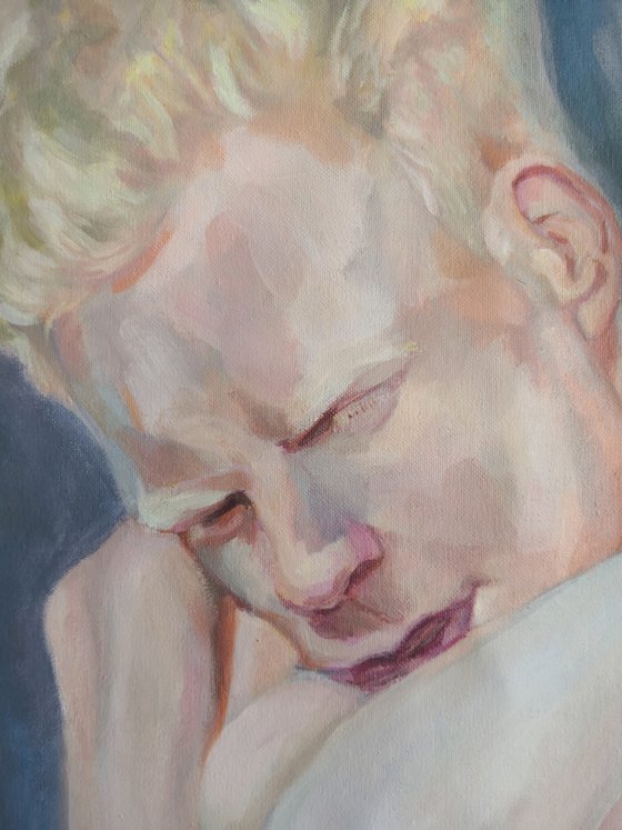 Albino youth