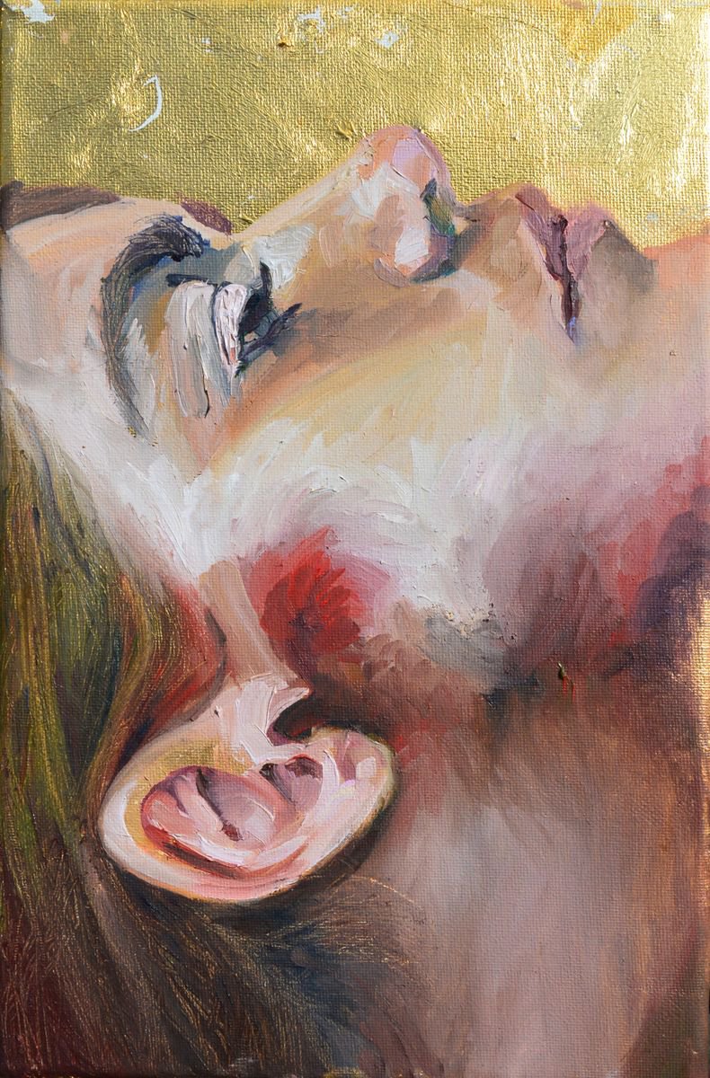 Self Portrait With a Broken Jaw by Suzana Dzelatovic