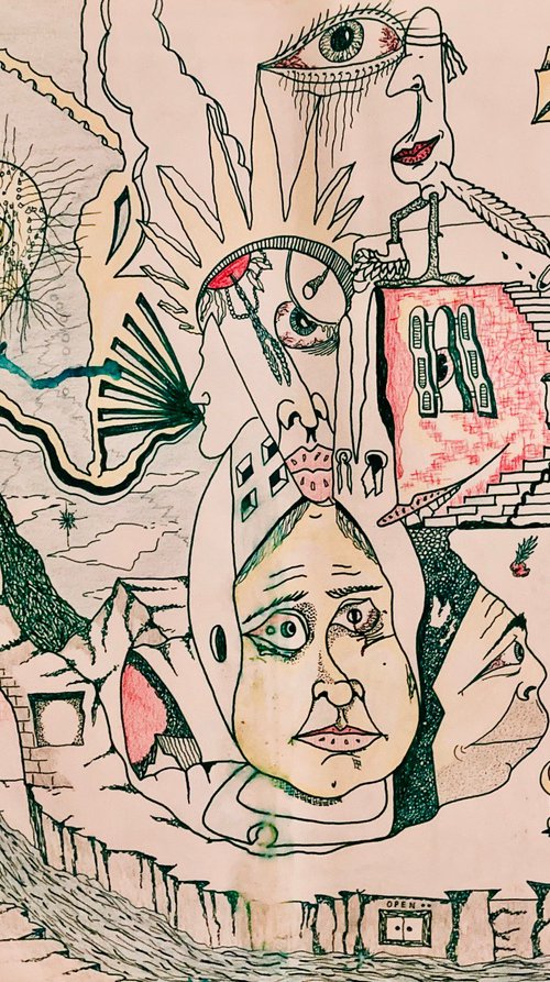 bunion removal by randy pratt