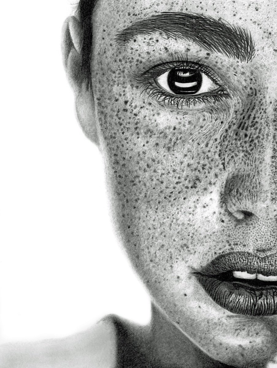 Freckles by Paul Stowe