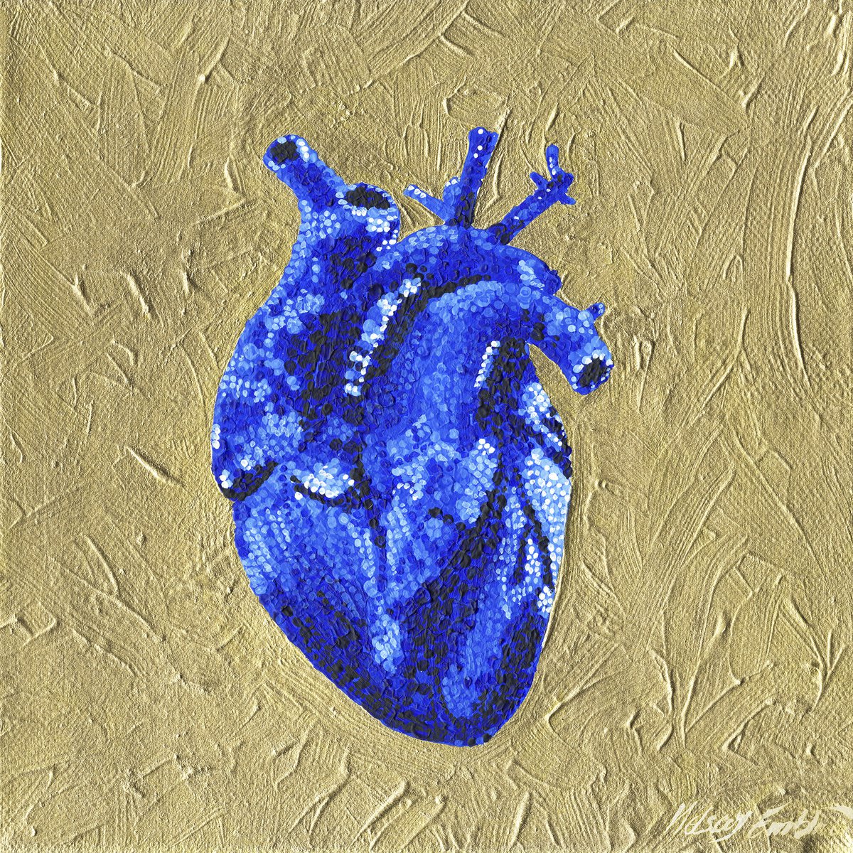  - Hypercholesterolemia - � Blue Monochrome Acrylic Painting by Kelsey Emblow