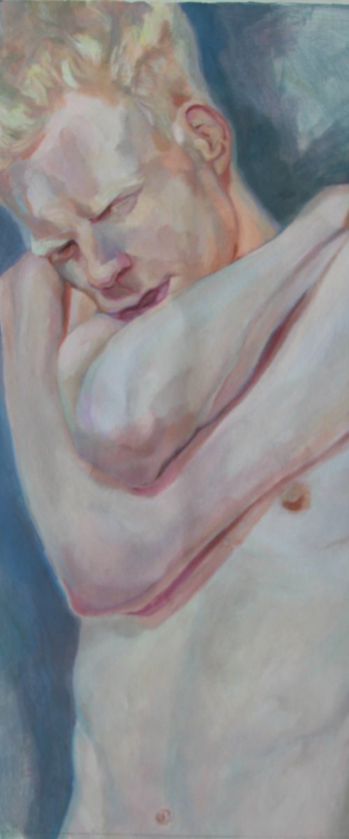 Albino youth by Anyck Alvarez Kerloch