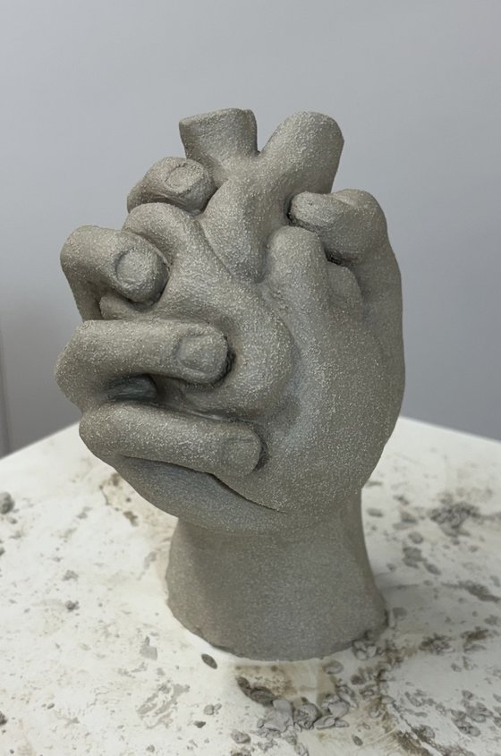 Under Pressure: Arrested Grey